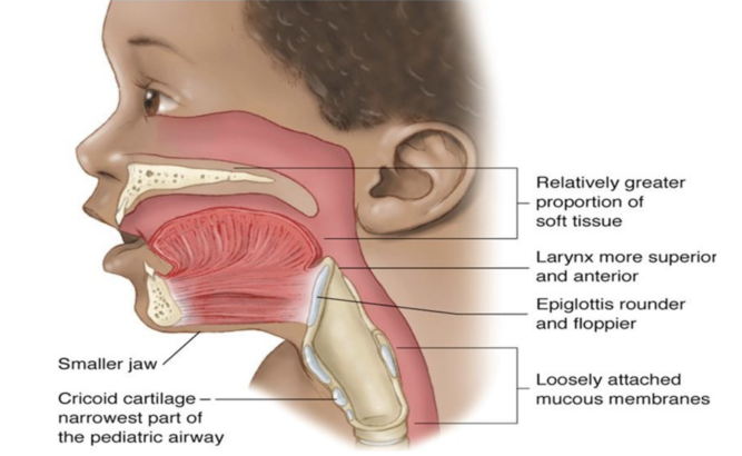 Differences in the pediatric airway diagram